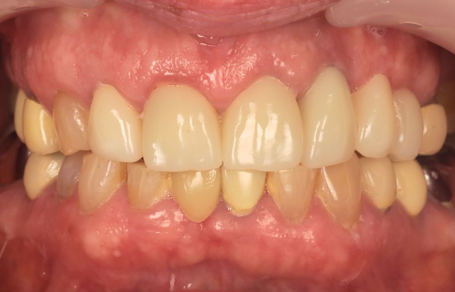 After -Ashbourne Road Dental