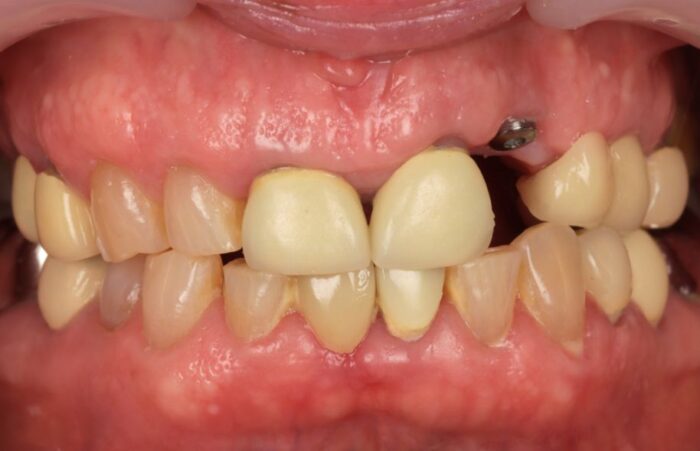 Before - Ashbourne Road Dental