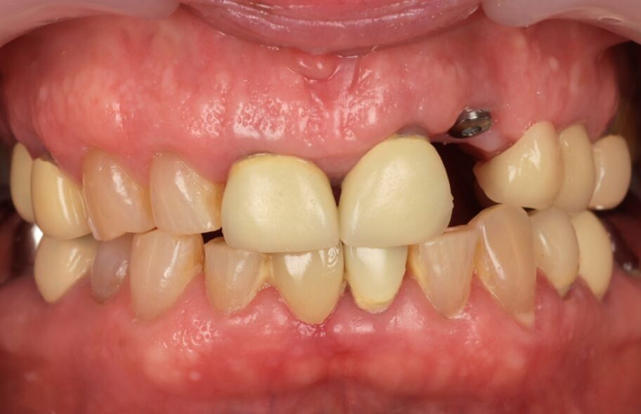 Before - Ashbourneroad Dental