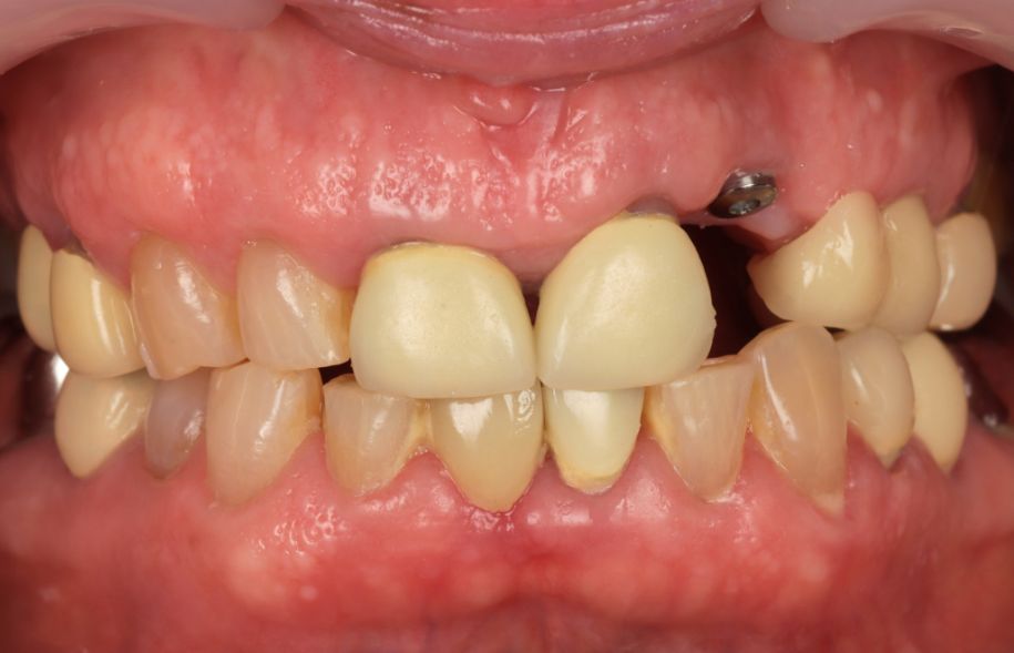 Before - Ashbourne Road Dental