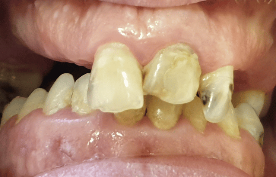 Before - Ashbourne Road Dental