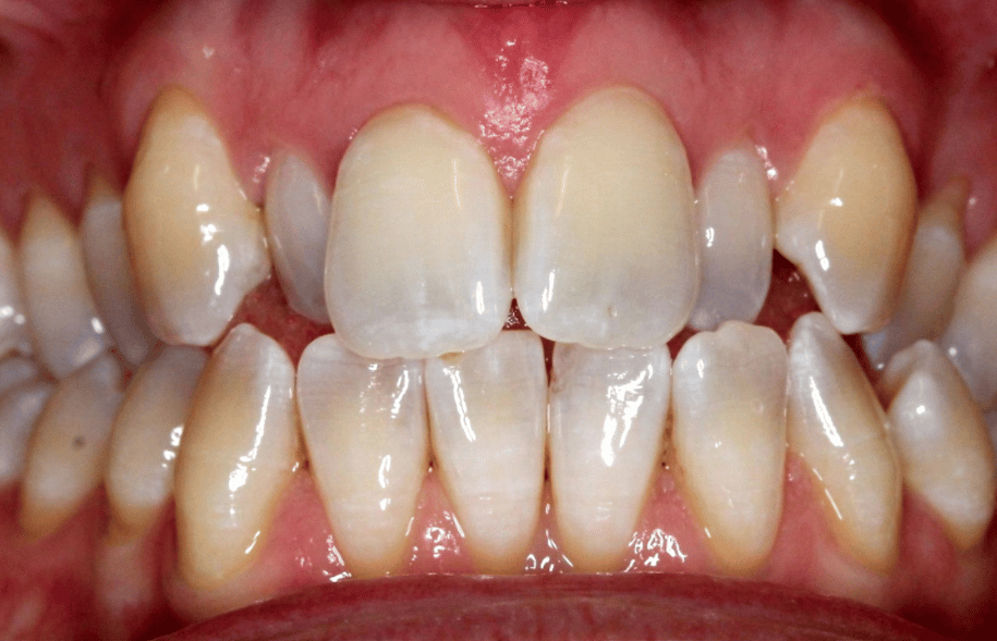Before - Ashbourne Road Dental