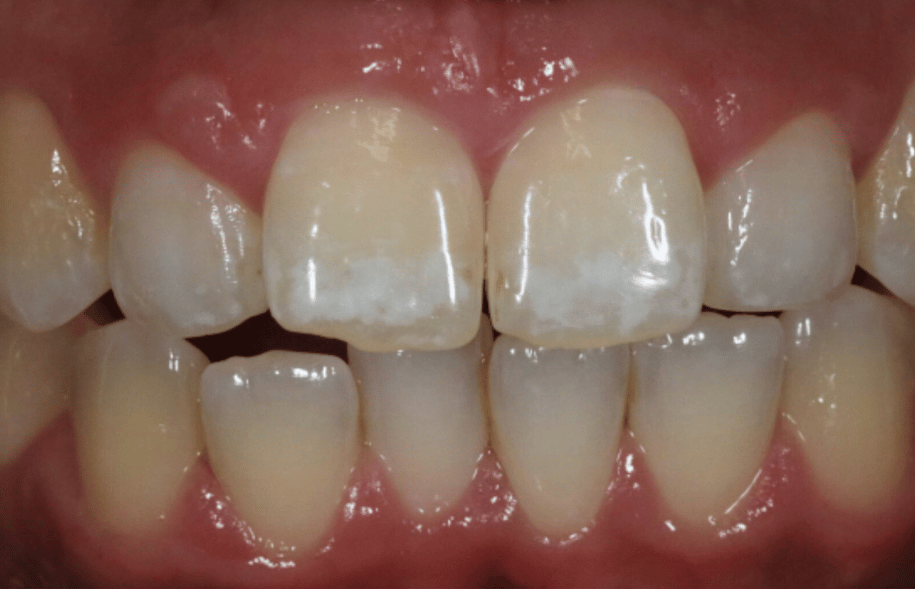Before - Ashbourne Road Dental