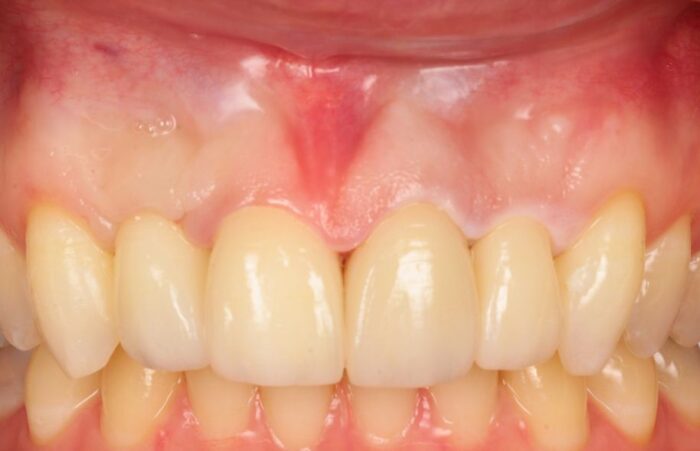 After -Ashbourne Road Dental