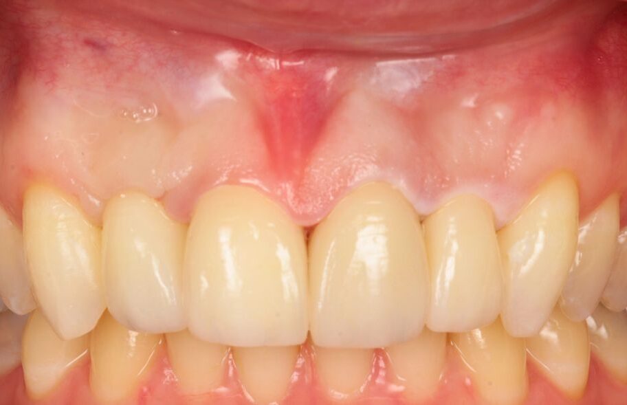 After - Ashbourneroad Dental