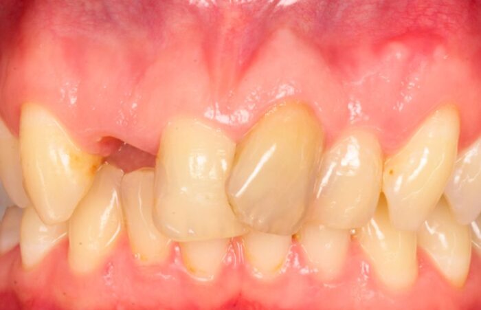 Before - Ashbourne Road Dental