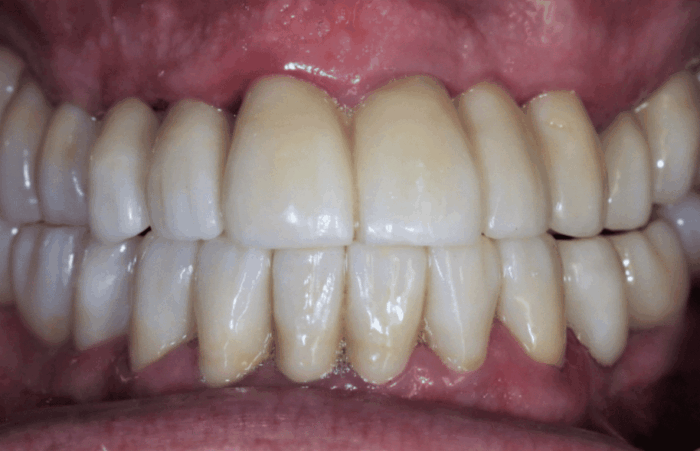 After -Ashbourne Road Dental