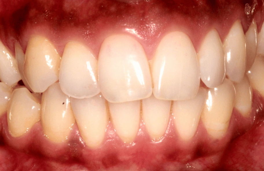 Before - Ashbourneroad Dental