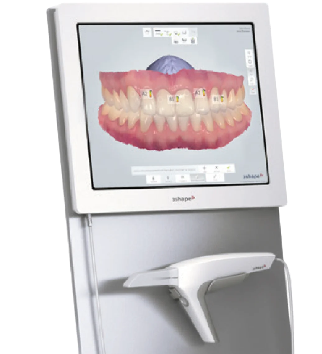 3D Scanner
