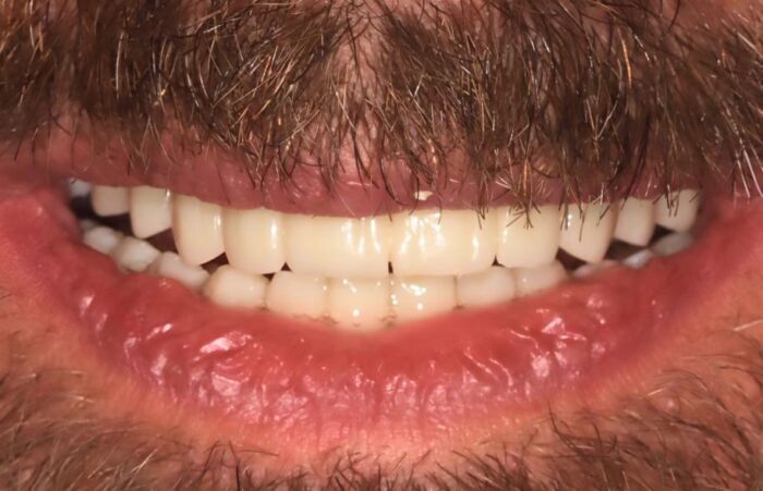 After -Ashbourne Road Dental