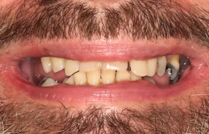 Before - Ashbourne Road Dental