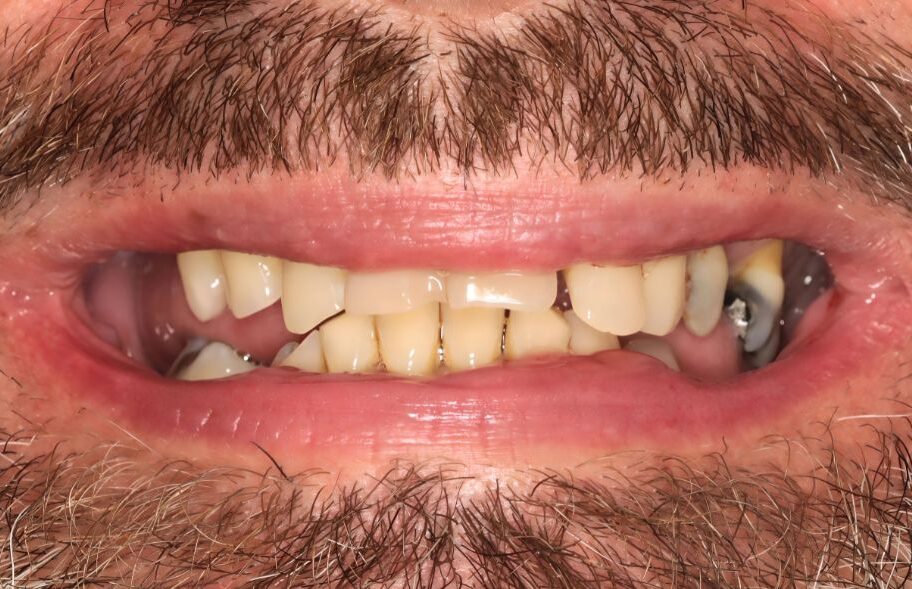 Before - Ashbourneroad Dental