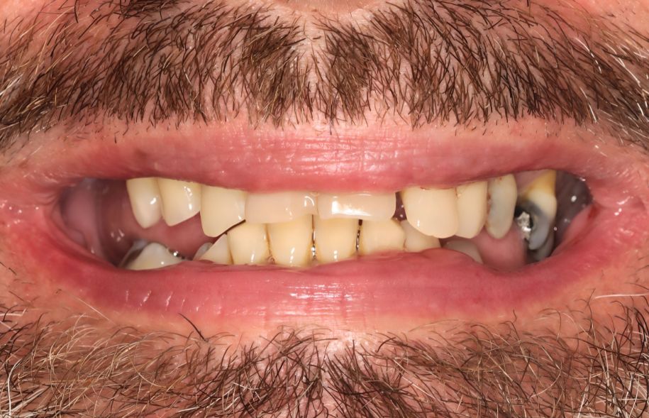 Before - Ashbourne Road Dental