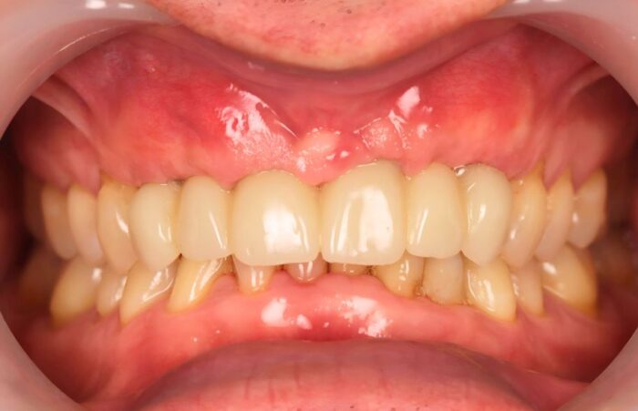 After -Ashbourne Road Dental
