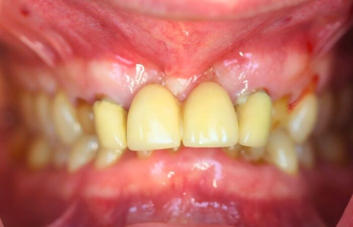 Before - Ashbourne Road Dental