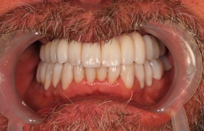 After -Ashbourne Road Dental