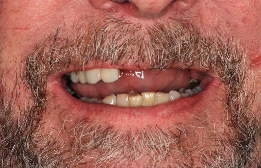Before - Ashbourne Road Dental