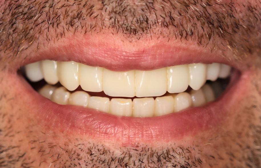 After -Ashbourne Road Dental