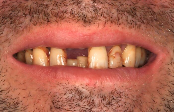 Before - Ashbourne Road Dental