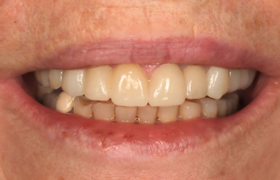 After -Ashbourne Road Dental