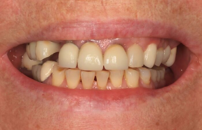 Before - Ashbourne Road Dental