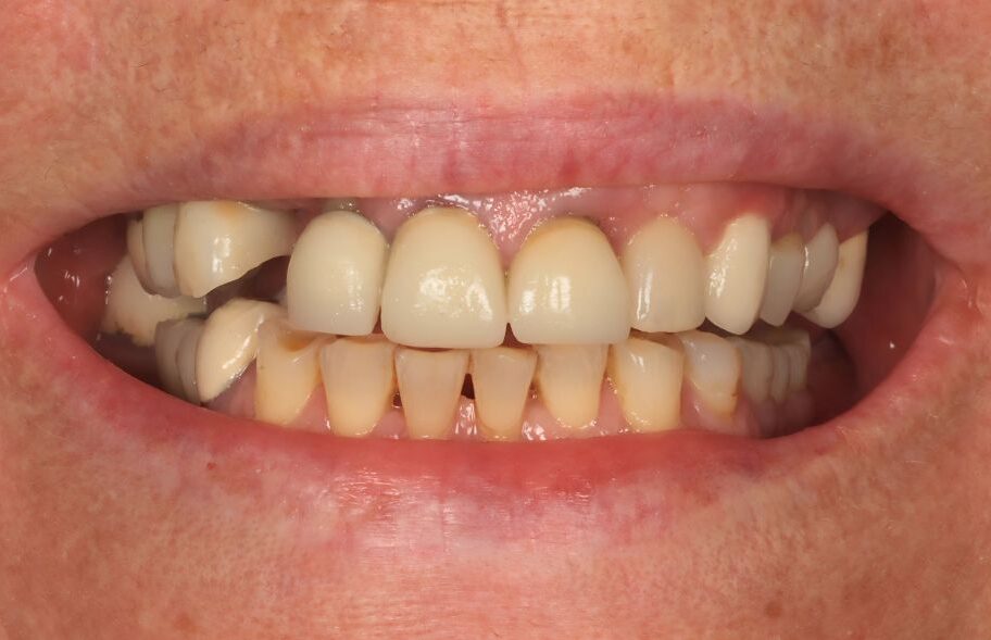 Before - Ashbourneroad Dental