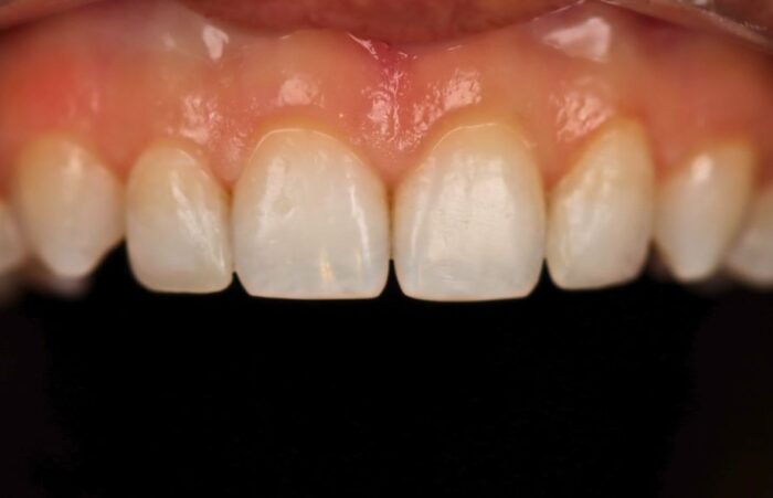 After -Ashbourne Road Dental
