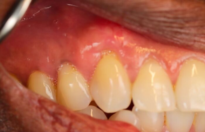 After -Ashbourne Road Dental