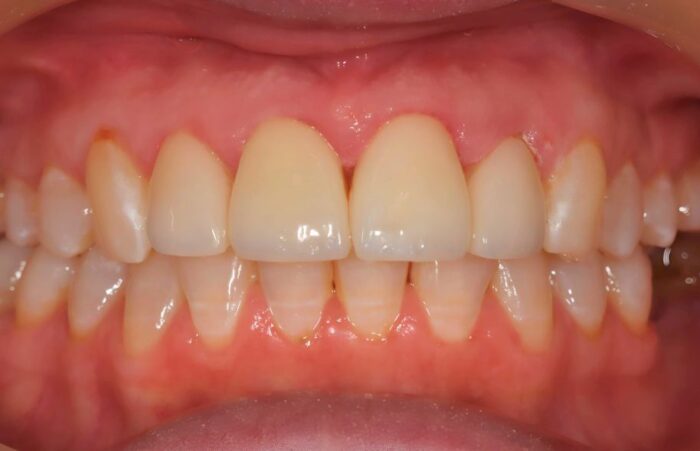 After -Ashbourne Road Dental