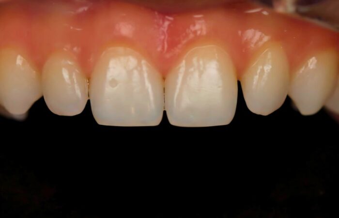 Before - Ashbourne Road Dental