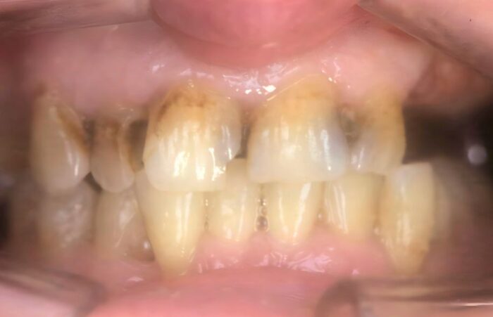 Before - Ashbourne Road Dental