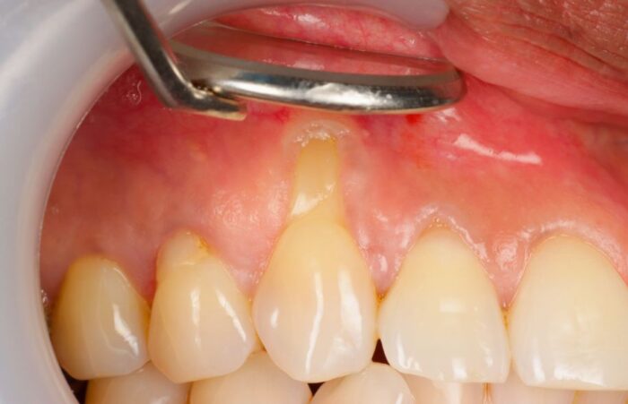 Before - Ashbourne Road Dental