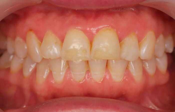 Before - Ashbourne Road Dental