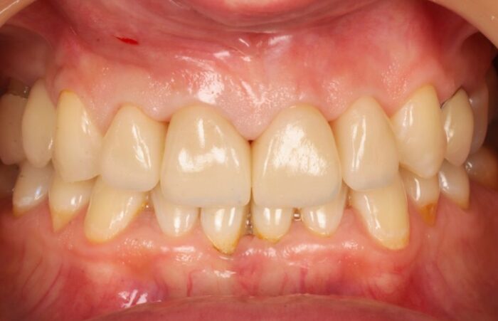 After -Ashbourne Road Dental