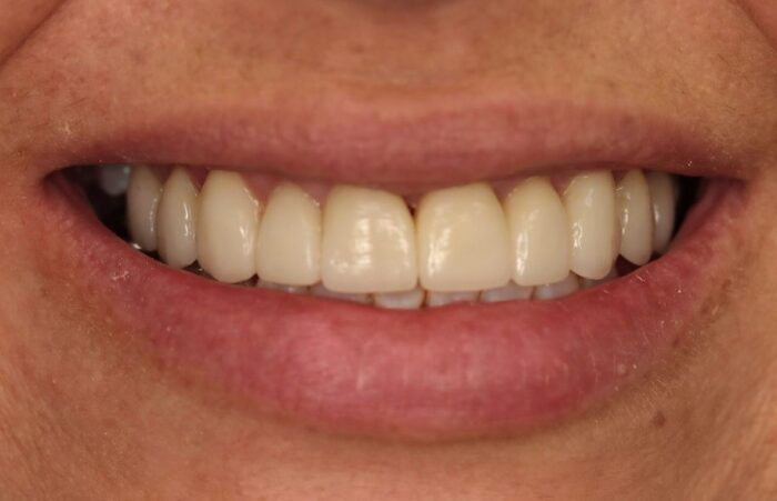 After -Ashbourne Road Dental