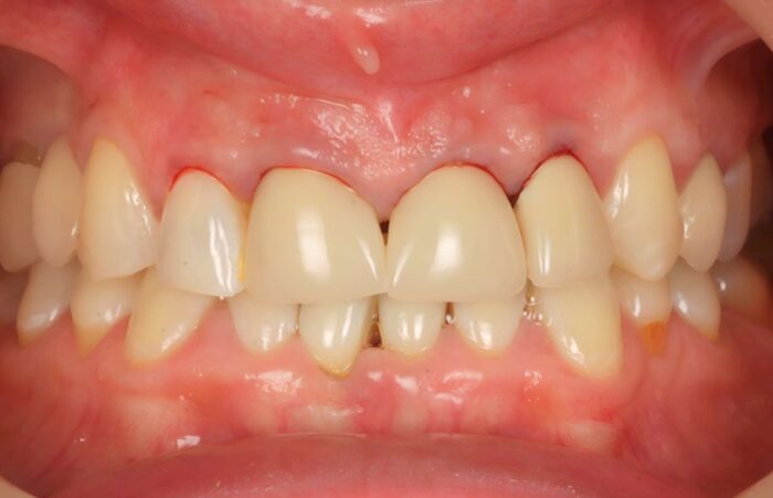 Before - Ashbourne Road Dental