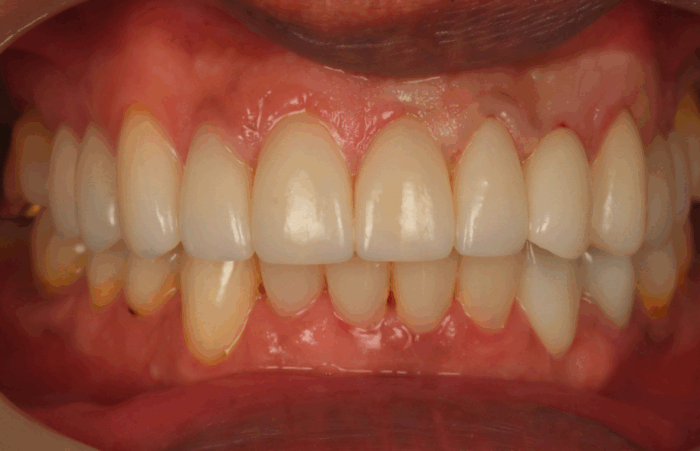 After -Ashbourne Road Dental