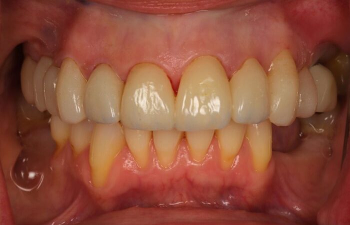 After -Ashbourne Road Dental
