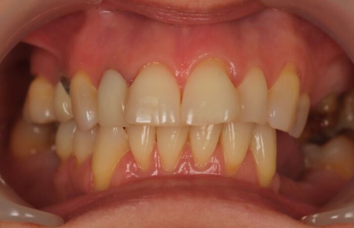 Before - Ashbourne Road Dental
